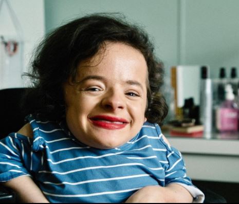 Vlogger with rare genetic condition seeks to redefine ‘beauty ideals’
