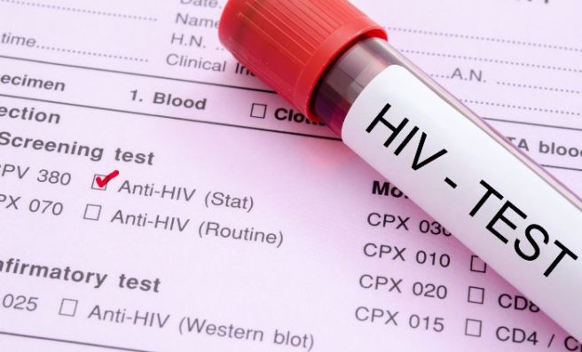 Man charged with murder after girlfriend dies from AIDS virus