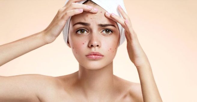This hormone chart can tell when you’re most likely to get spots
