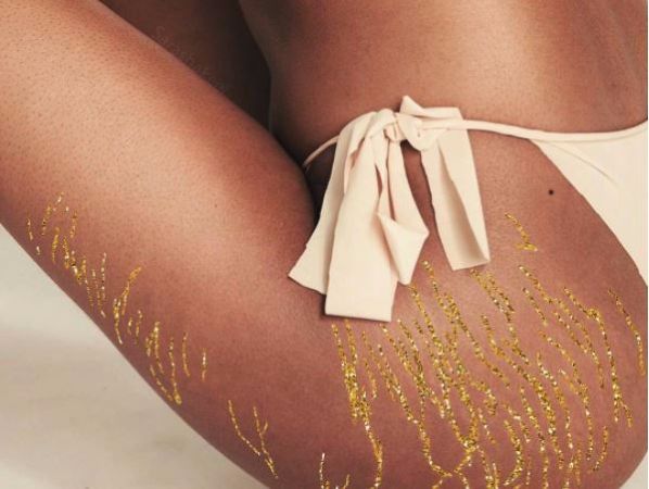 Meet the Instagrammer celebrating women’s stretchmarks… with glitter
