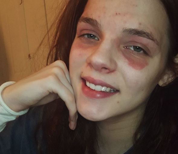 This MUA is empowering people suffering from skin conditions