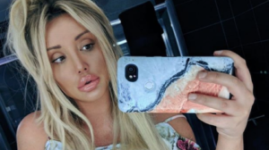 Charlotte Crosby chastises ‘lip police’ after ridicule for plump pout