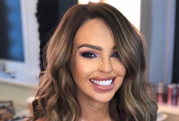 Everybody needs to see Katie Piper’s #10YearChallenge post