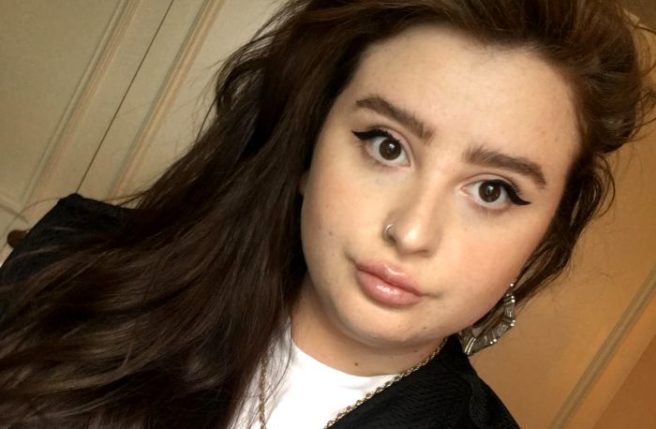 Read my lips: My experience at Dublin’s new speciality filler clinic