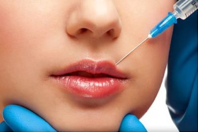 Irish clinic posts important reminder about getting lip fillers