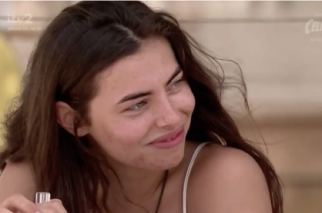 Real beauty within perfect people: Valuing acne scars on Love Island