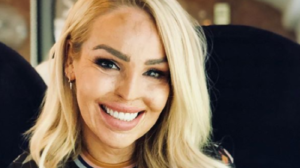 WMHD: Katie Piper posts harrowing photo of her acid attack injuries