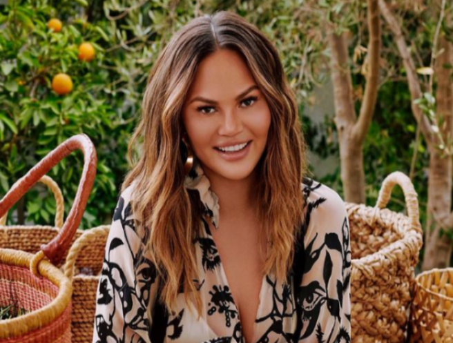 Chrissy Teigen shows off her brow transplant surgery results