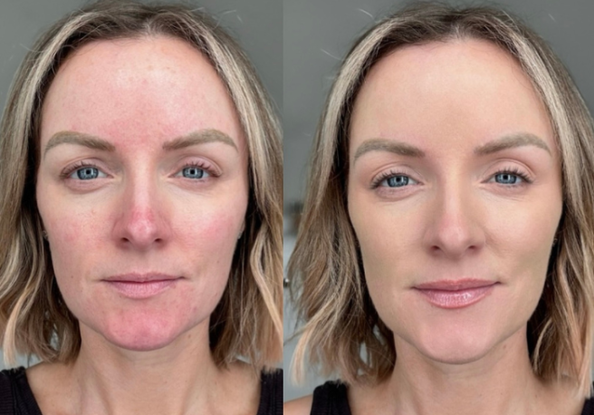 Treat your skin to Ayu Cosmetics’ Anti-Redness Cream SPF 30