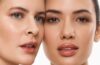 Skin Boosters: The Injectable Skincare Trend Celebs Swear By
