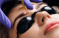 Thérapie Clinic can now remove your old microbladed brows
