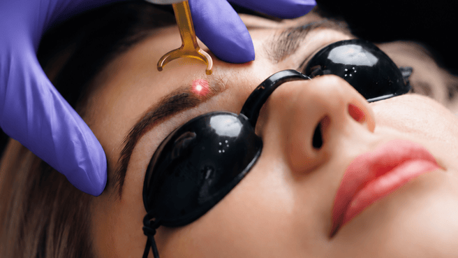 Thérapie Clinic can now remove your old microbladed brows